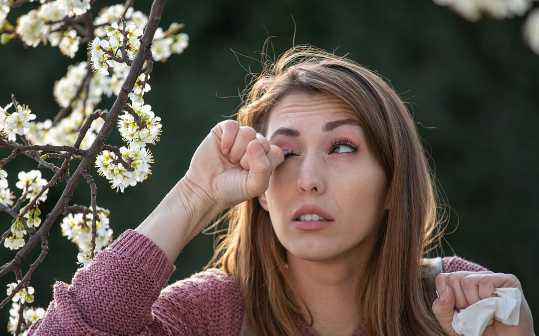 What Are Allergy Eyes?